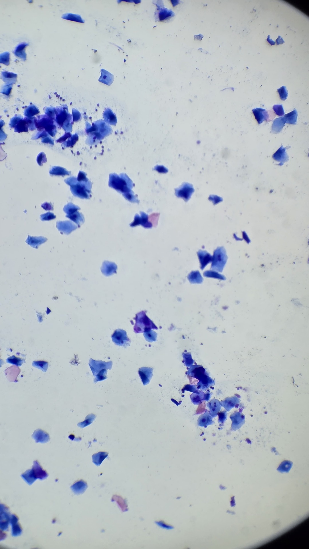 Citologia vaginal canina ao microscópio