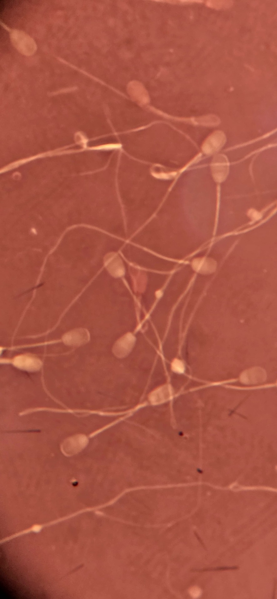 Espermograma — análise de sêmen ao microscópio